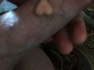 Mi perla (implante) en mi verga: d